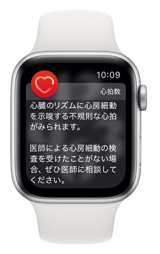 心房細動（AFib）の兆候Apple Watchの通知機能